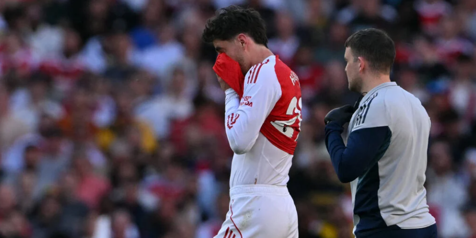 Kai Havertz Terjebak dalam Lingkaran Setan Cedera: Performa Mengecewakan dan Perpanjangan Kontrak yang Menggantung